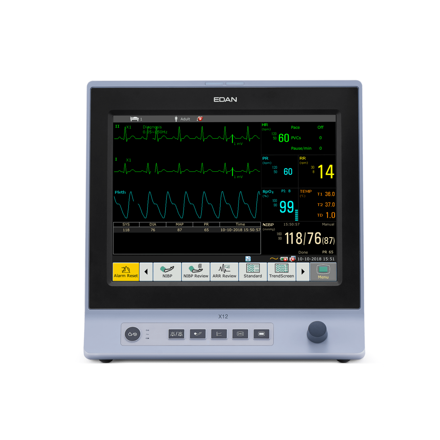 edan-x12-patient-monitor-aie-llc